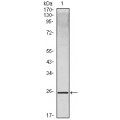 anti-HYAL1 antibody (Hyaluronidase-1) (N-Term)