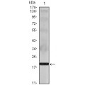anti-HYAL1 antibody (Hyaluronidase-1) (N-Term)
