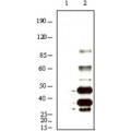 anti-HYAL1 antibody (Hyaluronidase-1) (N-Term)