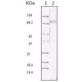 anti-HYAL1 antibody (Hyaluronidase-1) (N-Term)