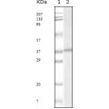 anti-HYAL1 antibody (Hyaluronidase-1) (N-Term)