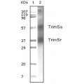 anti-HYAL1 antibody (Hyaluronidase-1) (N-Term)