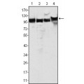 anti-HYAL1 antibody (Hyaluronidase-1) (N-Term)