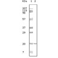 anti-HYAL1 antibody (Hyaluronidase-1) (N-Term)