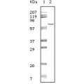 anti-HYAL1 antibody (Hyaluronidase-1) (N-Term)
