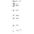 anti-HYAL1 antibody (Hyaluronidase-1) (N-Term)