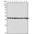 anti-HYAL1 antibody (Hyaluronidase-1) (N-Term)
