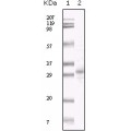 anti-HYAL1 antibody (Hyaluronidase-1) (N-Term)
