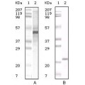 anti-HYAL1 antibody (Hyaluronidase-1) (N-Term)