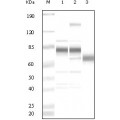 anti-HYAL1 antibody (Hyaluronidase-1) (N-Term)