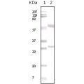 anti-HYAL1 antibody (Hyaluronidase-1) (N-Term)