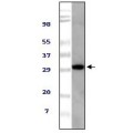anti-HYAL1 antibody (Hyaluronidase-1) (N-Term)