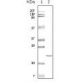 anti-HYAL1 antibody (Hyaluronidase-1) (N-Term)