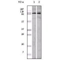 anti-HYAL1 antibody (Hyaluronidase-1) (N-Term)