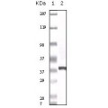 anti-HYAL1 antibody (Hyaluronidase-1) (N-Term)