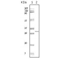 anti-HYAL1 antibody (Hyaluronidase-1) (N-Term)