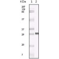 anti-HYAL1 antibody (Hyaluronidase-1) (N-Term)