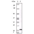 anti-HYAL1 antibody (Hyaluronidase-1) (N-Term)