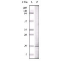anti-HYAL1 antibody (Hyaluronidase-1) (N-Term)