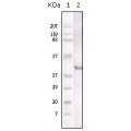 anti-HYAL1 antibody (Hyaluronidase-1) (N-Term)