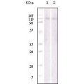 anti-HYAL1 antibody (Hyaluronidase-1) (N-Term)