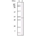 anti-HYAL1 antibody (Hyaluronidase-1) (N-Term)