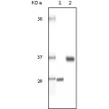 anti-HYAL1 antibody (Hyaluronidase-1) (N-Term)