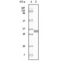 anti-HYAL1 antibody (Hyaluronidase-1) (N-Term)