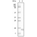 anti-HYAL1 antibody (Hyaluronidase-1) (N-Term)
