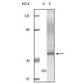 anti-HYAL1 antibody (Hyaluronidase-1) (N-Term)