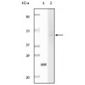anti-HYAL1 antibody (Hyaluronidase-1) (N-Term)