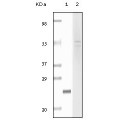 anti-HYAL1 antibody (Hyaluronidase-1) (N-Term)