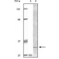 anti-HYAL1 antibody (Hyaluronidase-1) (N-Term)