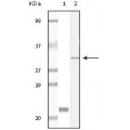 anti-HYAL1 antibody (Hyaluronidase-1) (N-Term)