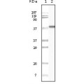 anti-HYAL1 antibody (Hyaluronidase-1) (N-Term)