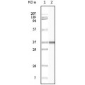 anti-HYAL1 antibody (Hyaluronidase-1) (N-Term)