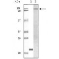 anti-HYAL1 antibody (Hyaluronidase-1) (N-Term)