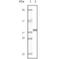 anti-HYAL1 antibody (Hyaluronidase-1) (N-Term)