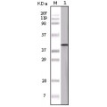anti-HYAL1 antibody (Hyaluronidase-1) (N-Term)