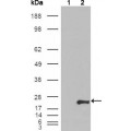 anti-HYAL1 antibody (Hyaluronidase-1) (N-Term)