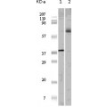 anti-HYAL1 antibody (Hyaluronidase-1) (N-Term)
