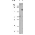 anti-HYAL1 antibody (Hyaluronidase-1) (N-Term)