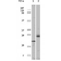 anti-HYAL1 antibody (Hyaluronidase-1) (N-Term)