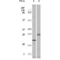 anti-HYAL1 antibody (Hyaluronidase-1) (N-Term)