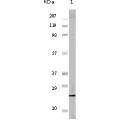 anti-HYAL1 antibody (Hyaluronidase-1) (N-Term)