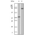 anti-HYAL1 antibody (Hyaluronidase-1) (N-Term)
