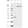 anti-HYAL1 antibody (Hyaluronidase-1) (N-Term)