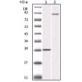 anti-HYAL1 antibody (Hyaluronidase-1) (N-Term)