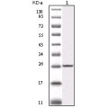 anti-HYAL1 antibody (Hyaluronidase-1) (N-Term)