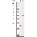 anti-HYAL1 antibody (Hyaluronidase-1) (N-Term)